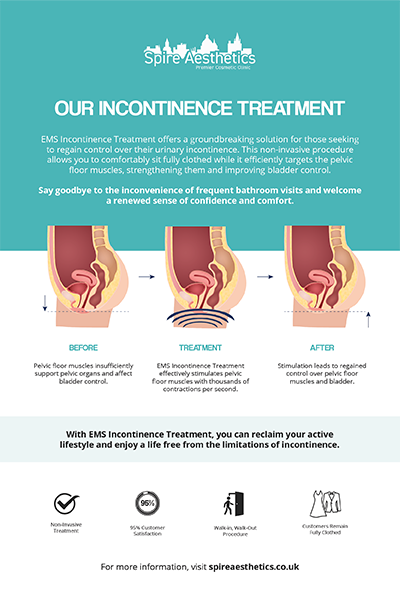 image to show how EMS treatment works for female urinary incontinence Kings Norton