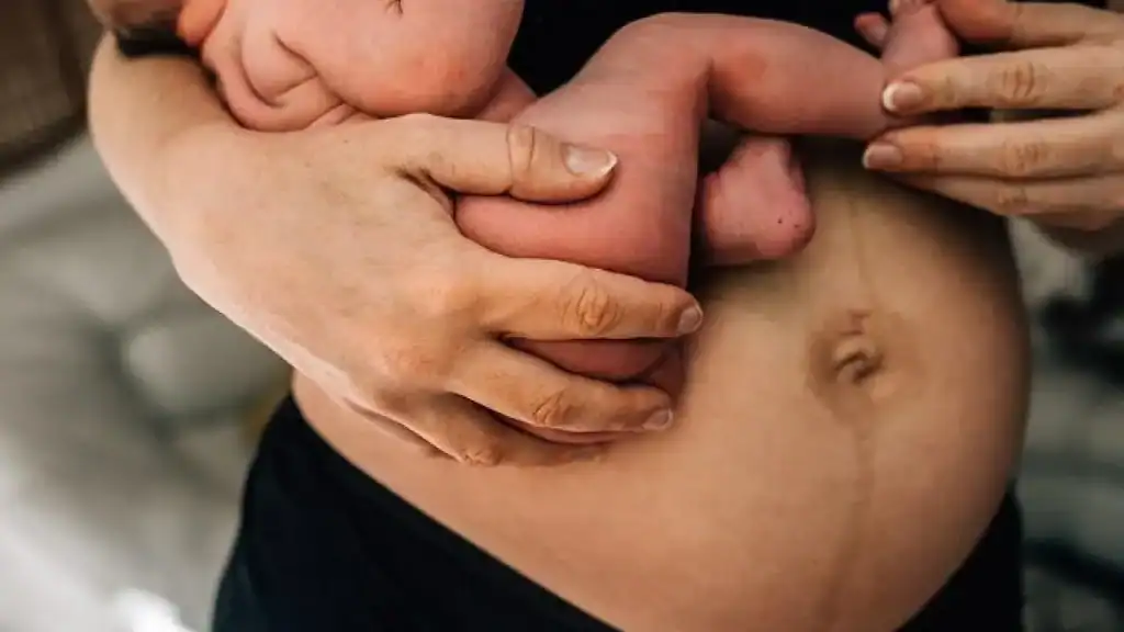 Why Is My Stomach Still Big After Pregnancy Kings Norton?